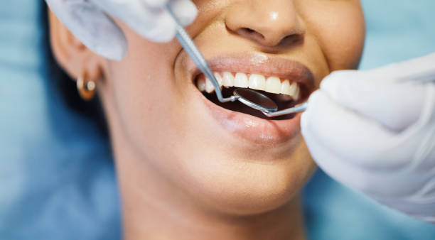 Best Emergency Dental Services for Seniors in Stevenson Ranch, CA