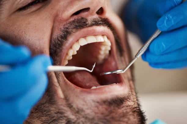 Best Mobile Emergency Dentist in Stevenson Ranch, CA
